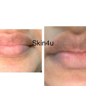 lip scrub, lighten lips, brighten lips lip gel